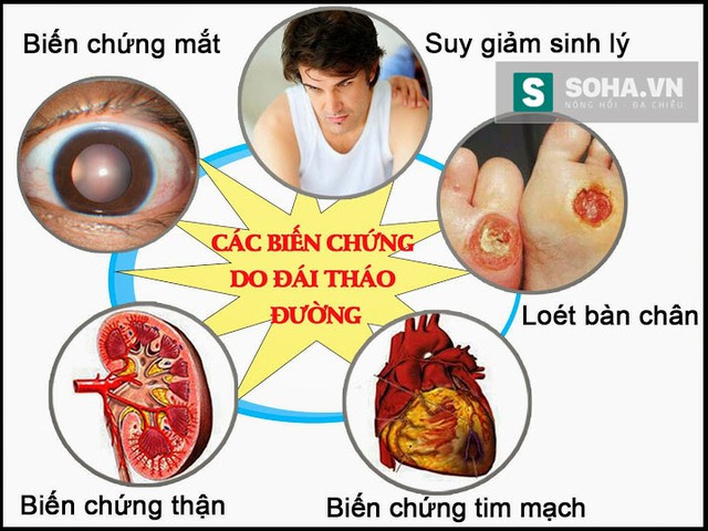 
Những biến chứng tiểu đường phổ biến nhất.
