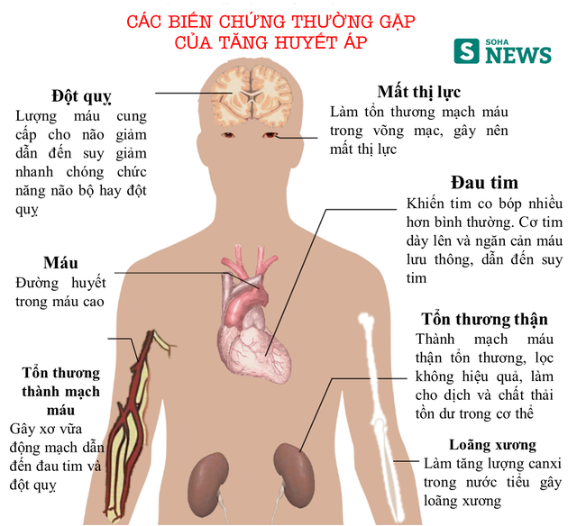 
Tăng huyết áp gây tổn hại đến toàn bộ cơ quan trên cơ thể
