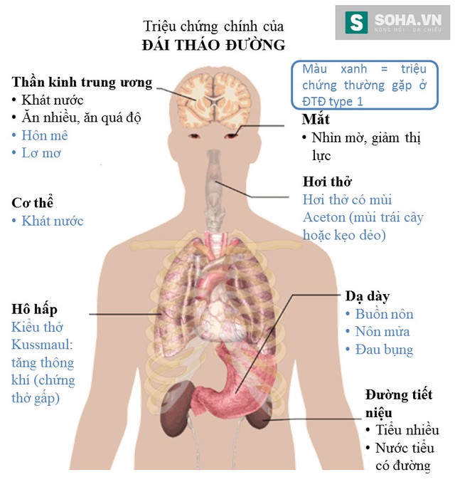 Triệu chứng tiểu đường type 1 và type 2