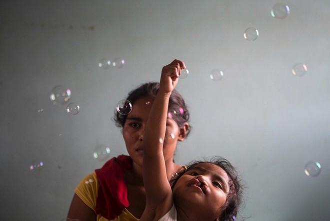 Bé gái chơi đùa với bong bóng trước khi trải qua ca phẫu thuật hở hàm ếch ở thành phố Managua, Nicaragua.