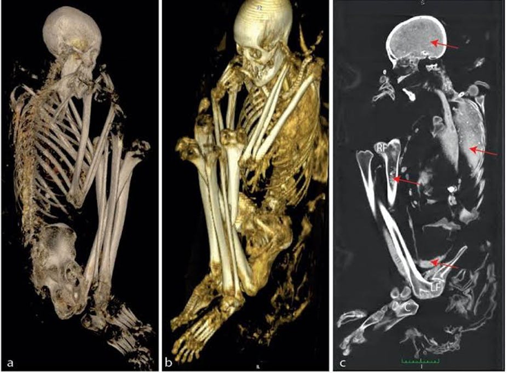 Phát hiện khảo cổ quái dị: Xét nghiệm ADN cho thấy xác ướp 3000 tuổi được chắp vá từ 6 di thể - Ảnh 3.