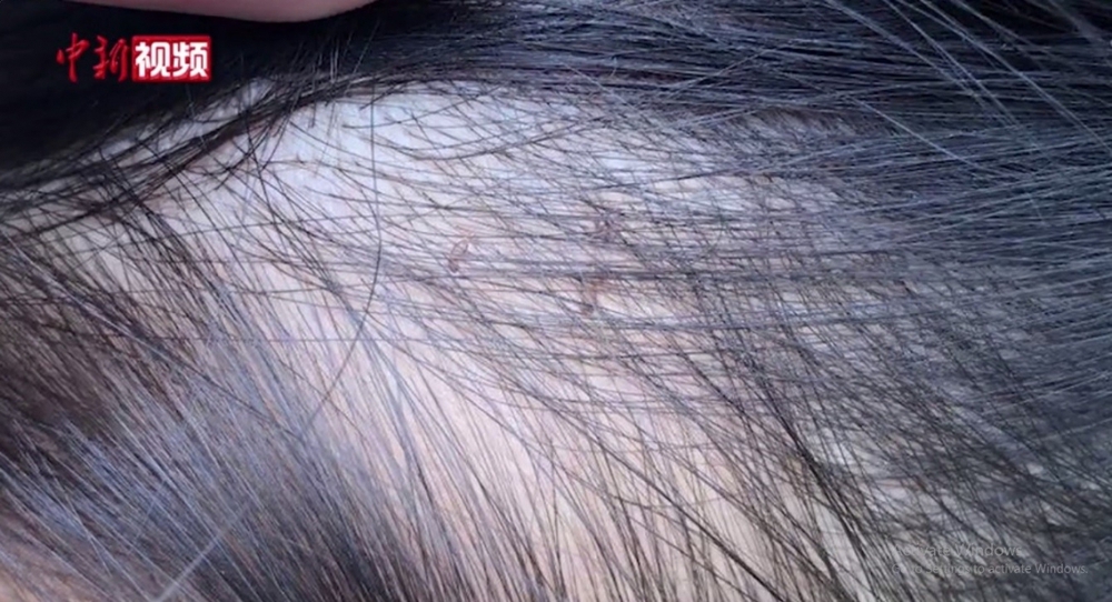 Trung Quốc bắt 3 giáo viên mầm non dùng kim châm vào người trẻ em - Ảnh 1.