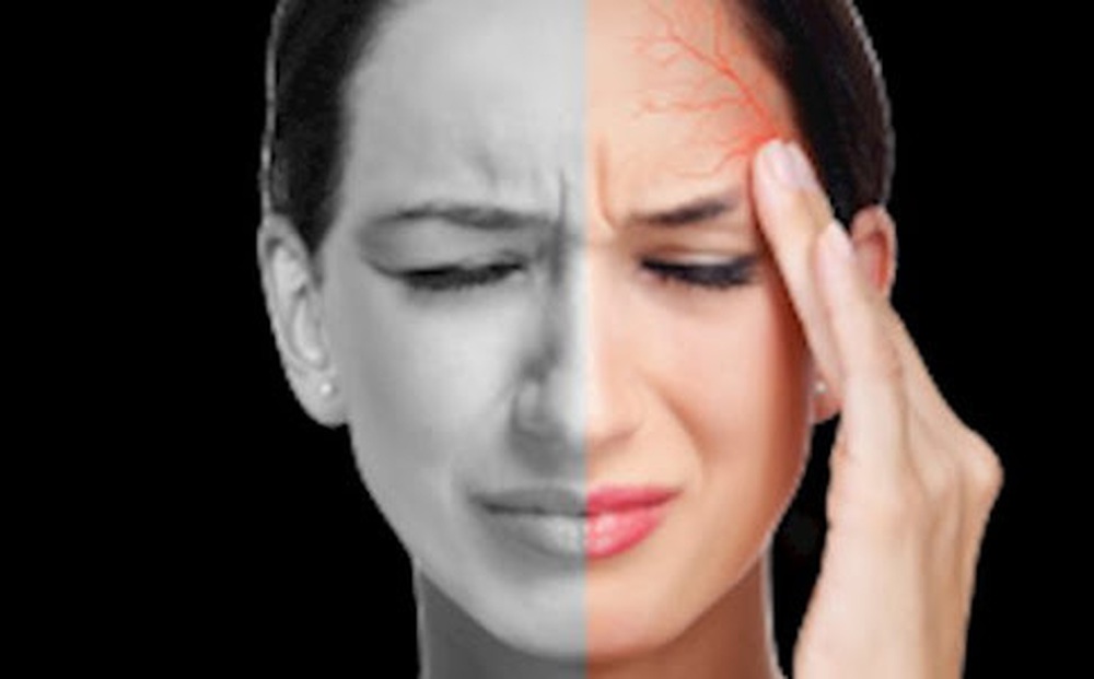 Chánh niệm có thể giúp giảm đau nửa đầu