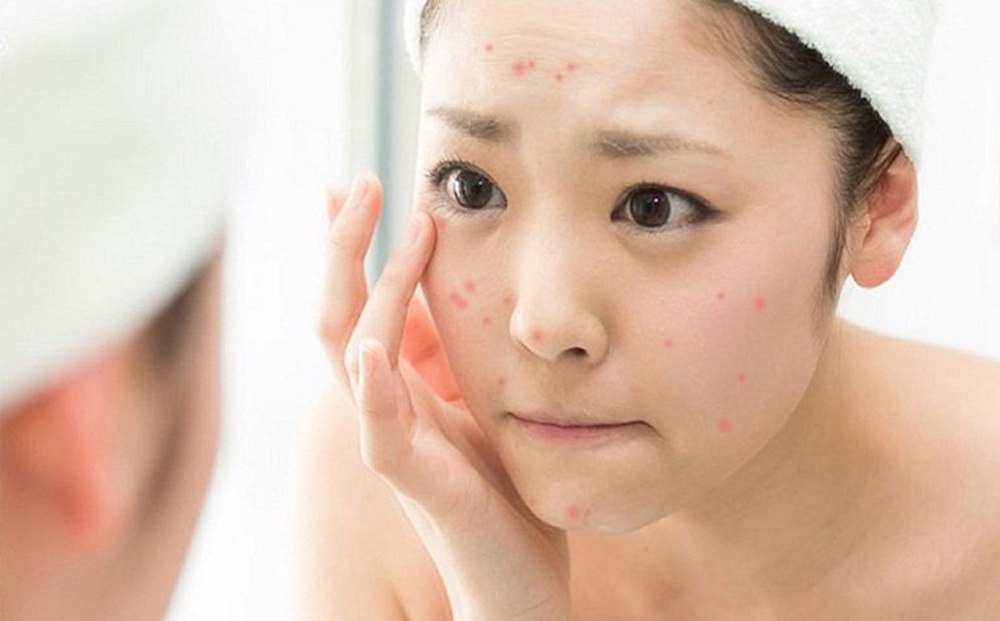 Vì sao thời điểm cuối năm làn da bị 'tàn phá' nhiều nhất?