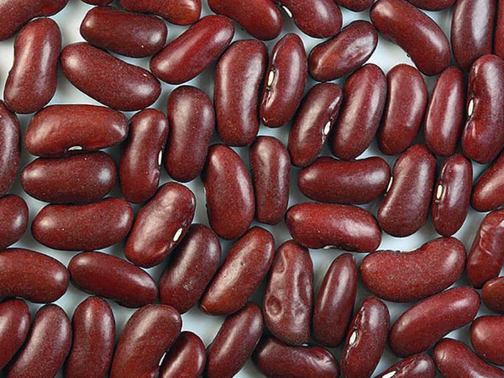 12 cách tự nhiên để thoát khỏi sỏi thận mà không cần phẫu thuật - Ảnh 11.
