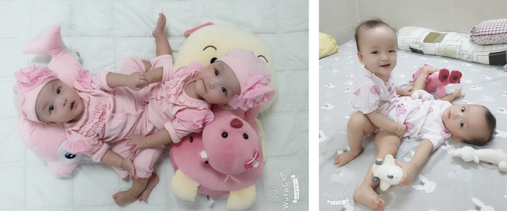 Hành trình 9 giờ từ đường rạch đầu tiên đến phòng hồi sức của 2 bé Trúc Nhi - Diệu Nhi - Ảnh 2.