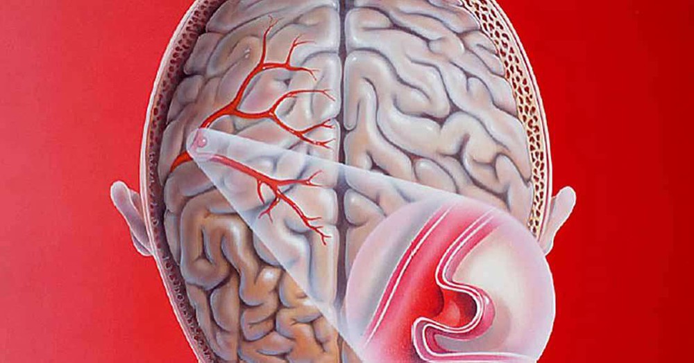 Uống rượu thường xuyên rất dễ rơi vào 4 hiểm họa lớn: Ai hay uống nên biết để tránh - Ảnh 3.