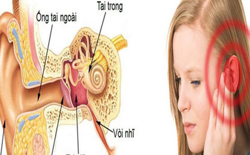 Ung thư ống tai ngoài: Đừng bỏ qua những bất thường ở tai!