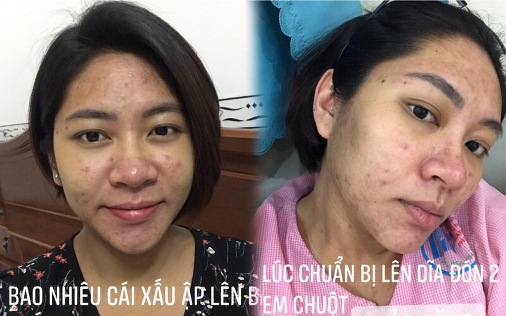Hình ảnh