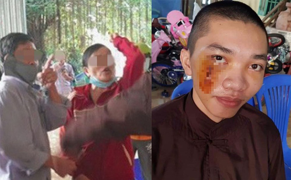 Một người ở Tịnh thất Bồng Lai chuẩn bị ra tòa: 'Vết thương dài 8 mũi mà đền 8 triệu bạc'