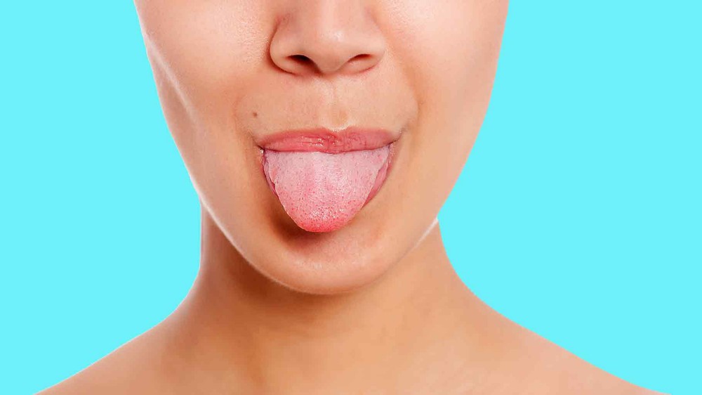 11 dấu hiệu ở lưỡi cảnh báo hàng loạt bệnh, từ COVID-19 đến ung thư - Ảnh 1.