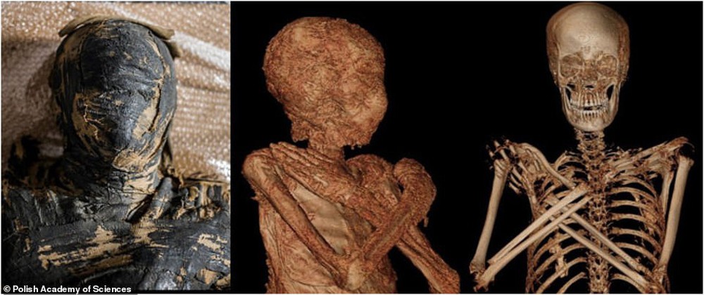 Phát hiện chấn động: Xác ướp Ai Cập cổ đại đầu tiên trên thế giới có bào thai trong bụng - Điều khiến chuyên gia kinh ngạc là gì? - Ảnh 1.