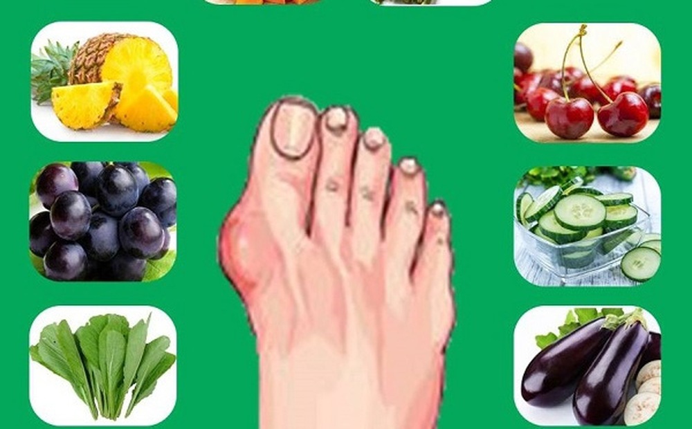 Người bệnh gút nên ăn gì?
