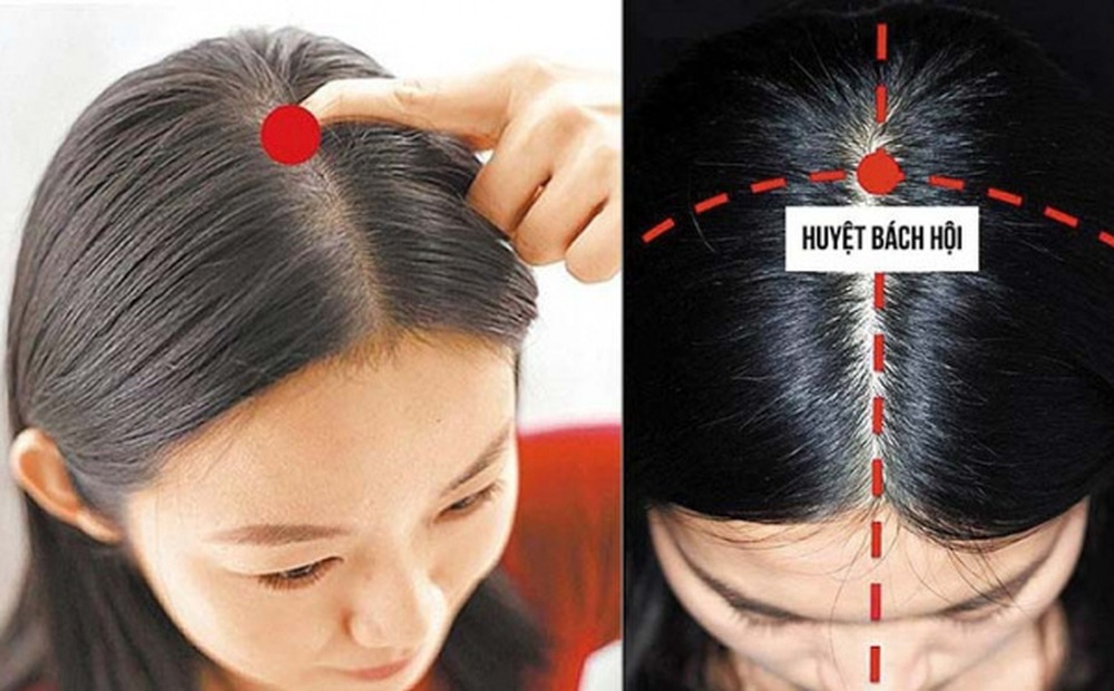 Bài thuốc trị thiếu máu não