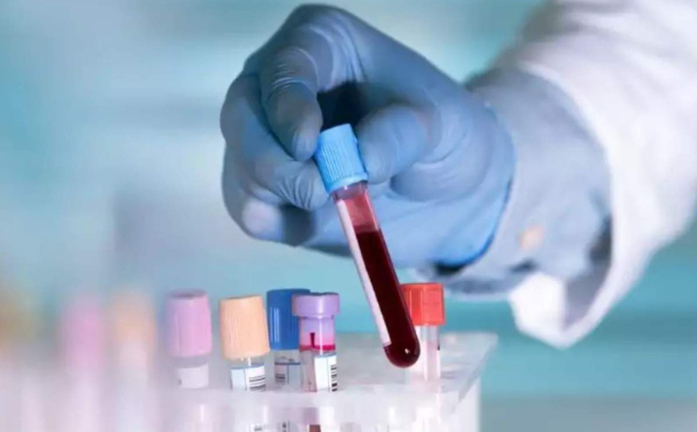 'Sốt ruột' về nguồn gốc Covid-19: WHO quyết định phân tích lại mẫu máu lưu trữ từ 2019 do Ý cung cấp