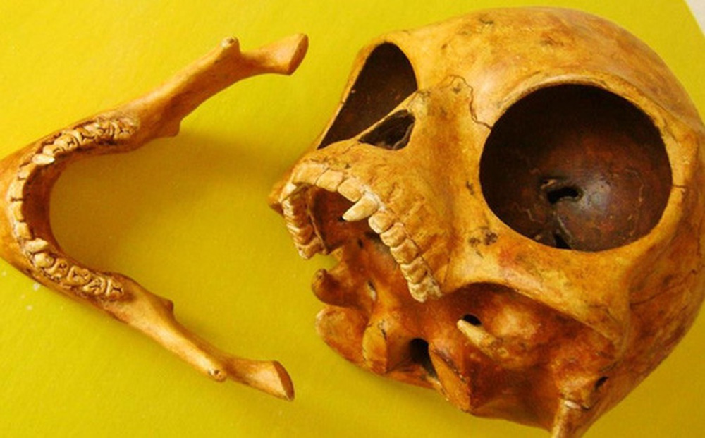 Những hộp sọ kỳ lạ nhất từng được phát hiện trong lịch sử