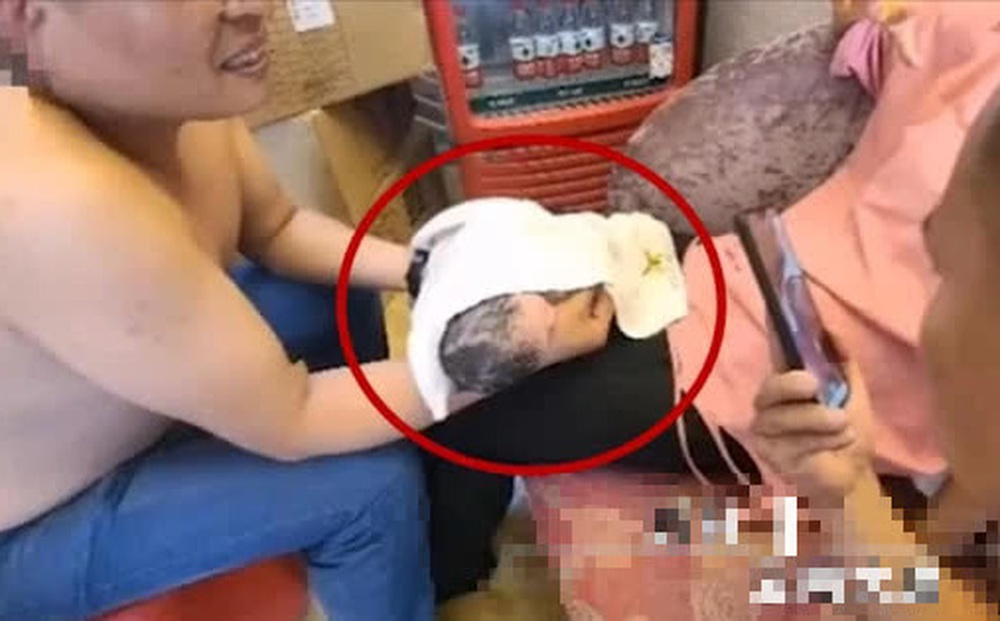 Đang làm thủ tục thuê phòng khách sạn, người phụ nữ khiến những người có mặt phát hoảng vì từ ống quần bất ngờ rơi ra "vật thể lạ"