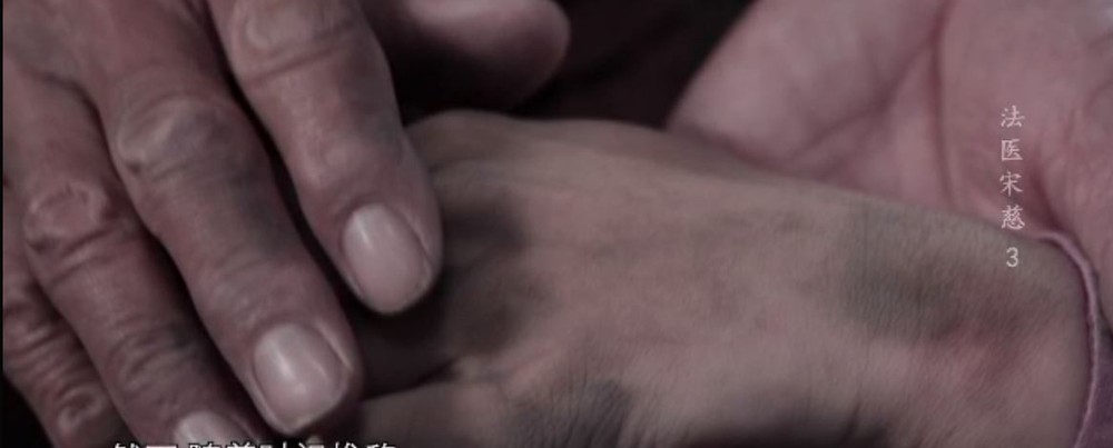 Thảm án nhuộm da người chết: Lão nông bế thi thể con gái đi kêu oan, chuyên gia lần theo manh mối - Tất cả vì 1 quả dưa! - Ảnh 1.