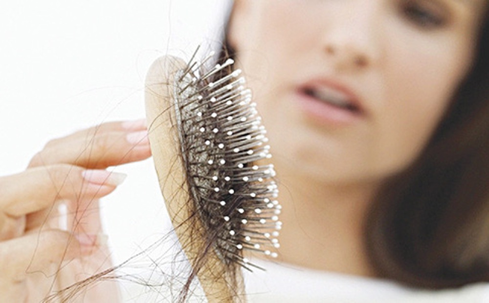 Rụng tóc bất thường coi chừng bệnh lý