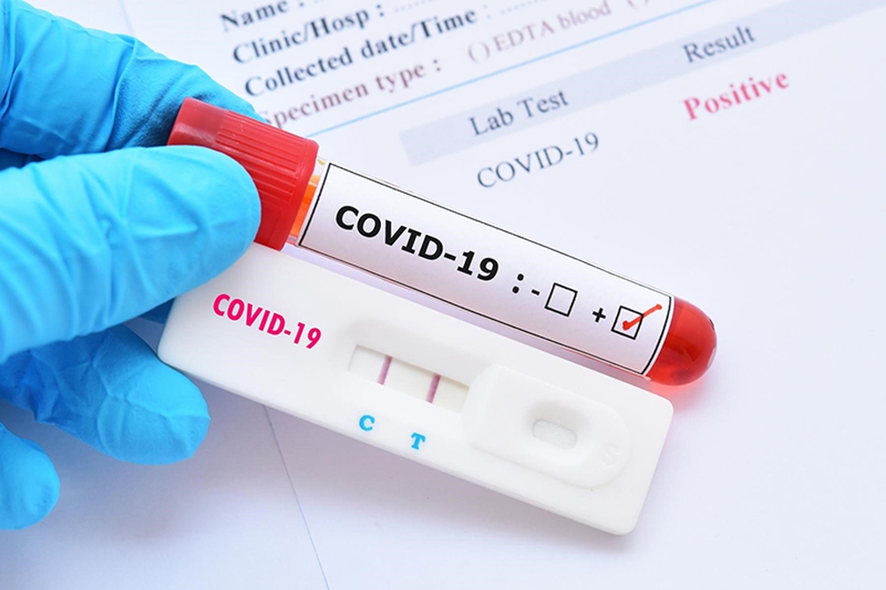 Dịch COVID-19 với bệnh nhân ung thư tiết niệu - Ảnh 3.