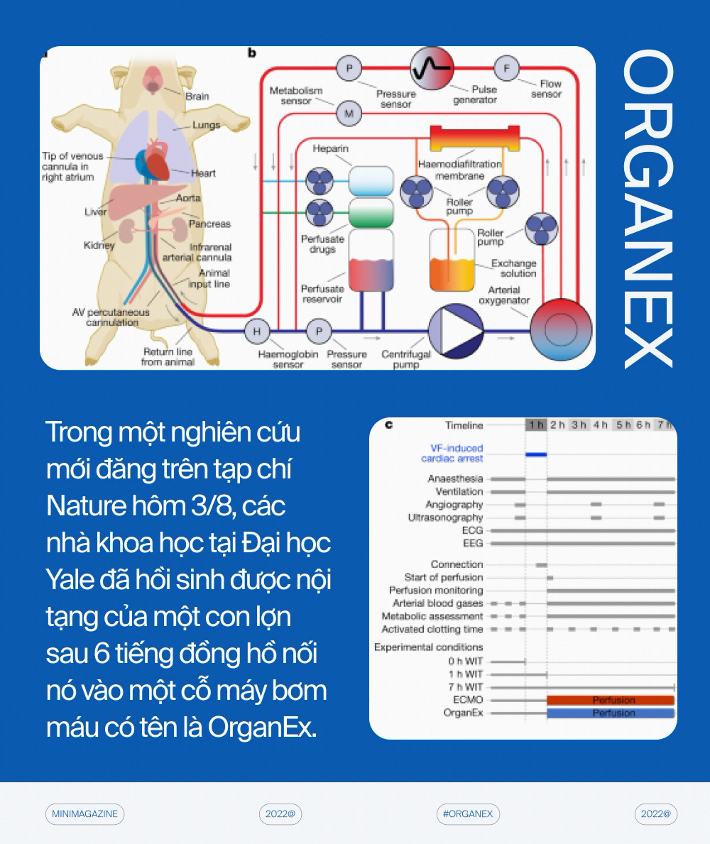 Với những cỗ máy hồi sinh, các nhà khoa học đang định nghĩa lại cái chết - Ảnh 2.