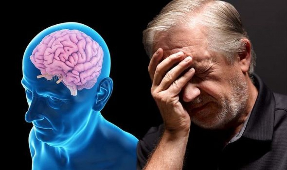 Thói quen không ngờ dẫn đến bệnh Alzheimer - Ảnh 1.