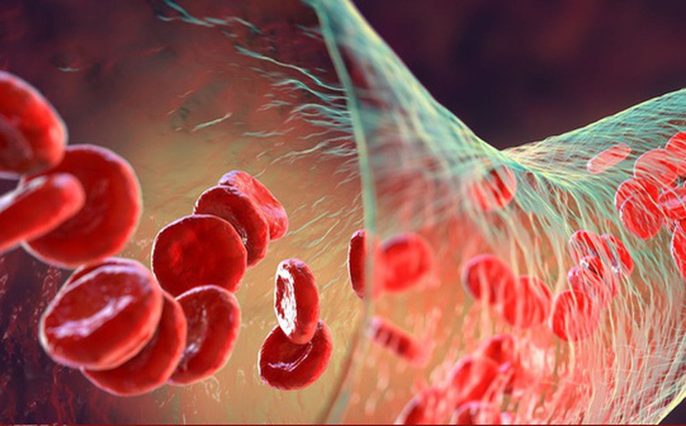 Tế bào hồng cầu nuôi cấy trong phòng thí nghiệm lần đầu tiên được truyền vào bệnh nhân