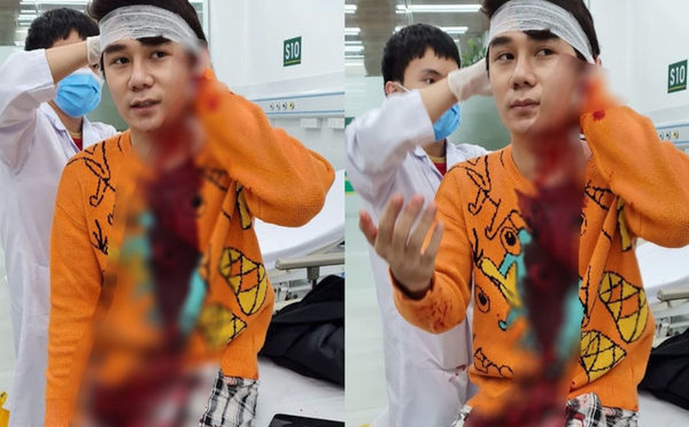 Lời khai của nghi phạm chém nam diễn viên trong phim 