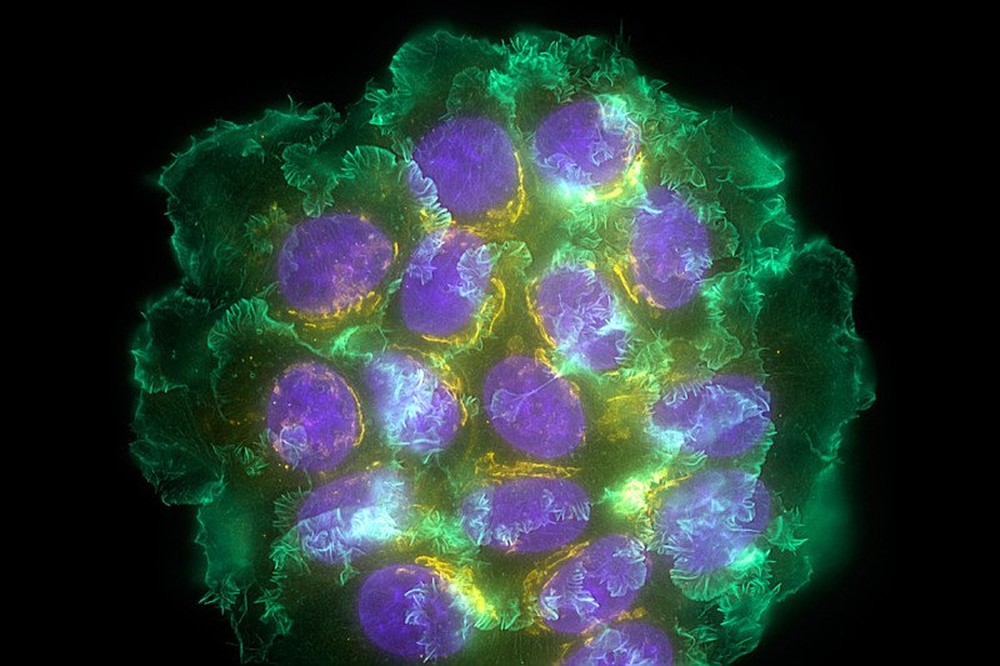 Giả thuyết ung thư thành tinh: Khi sống đủ lâu, các khối u sẽ tiến hóa thành sinh vật lây nhiễm? - Ảnh 1.