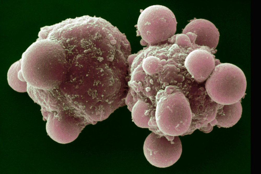 Giả thuyết ung thư thành tinh: Khi sống đủ lâu, các khối u sẽ tiến hóa thành sinh vật lây nhiễm? - Ảnh 10.