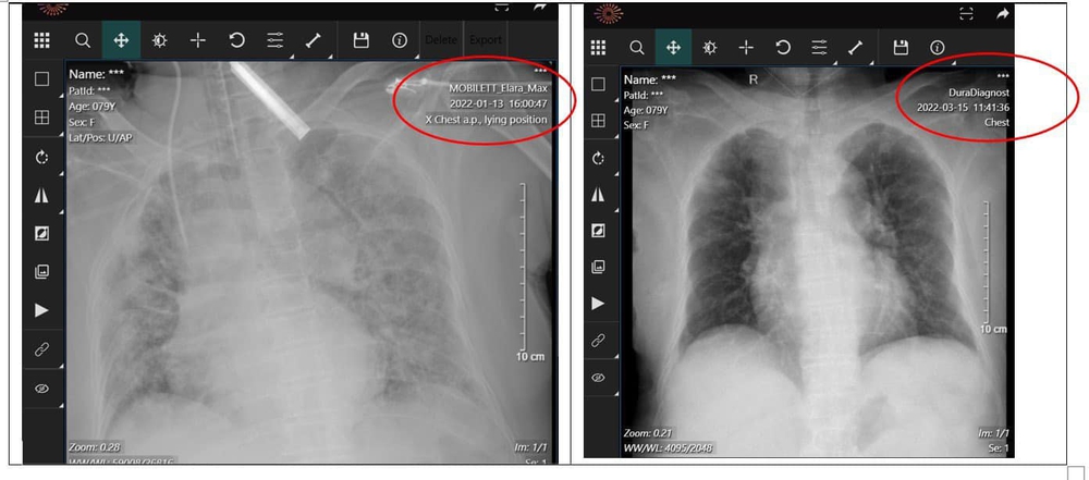 Deputy Director of Covid-19 Hospital Hoang Mai: Omicron + vaccine = post-COVID is no longer a concern - Photo 1.