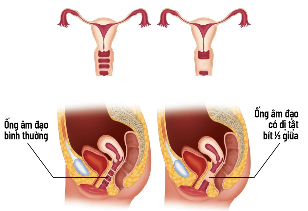 Đau bụng suốt 5 tháng, bé 11 tuổi đi khám, phát hiện thủ phạm không ngờ tới - Ảnh 1.