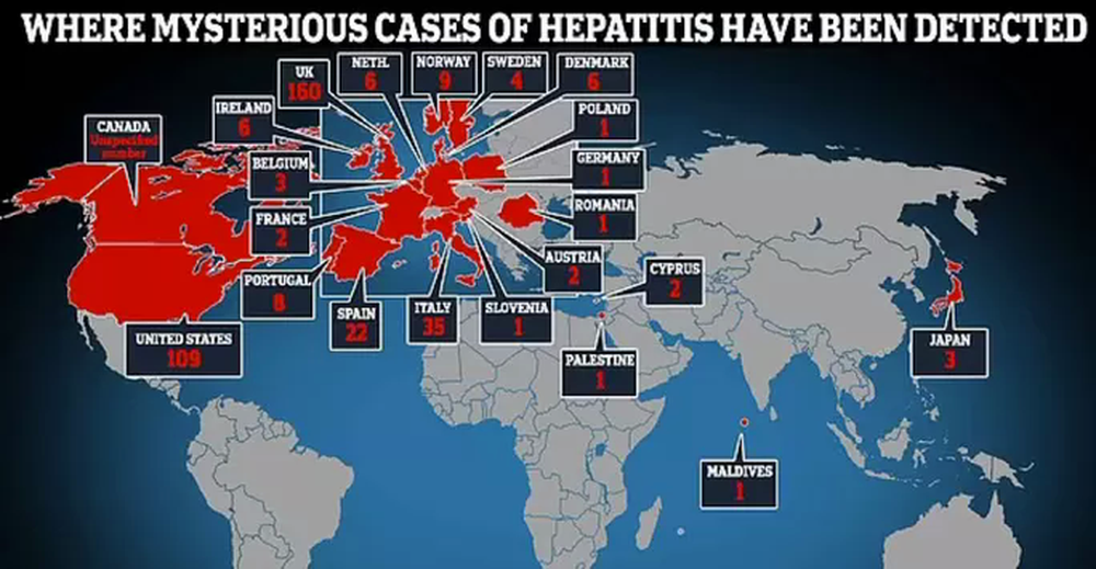 Bệnh viêm gan bí ẩn tiếp tục diễn biến phức tạp trên toàn thế giới  - Ảnh 1.