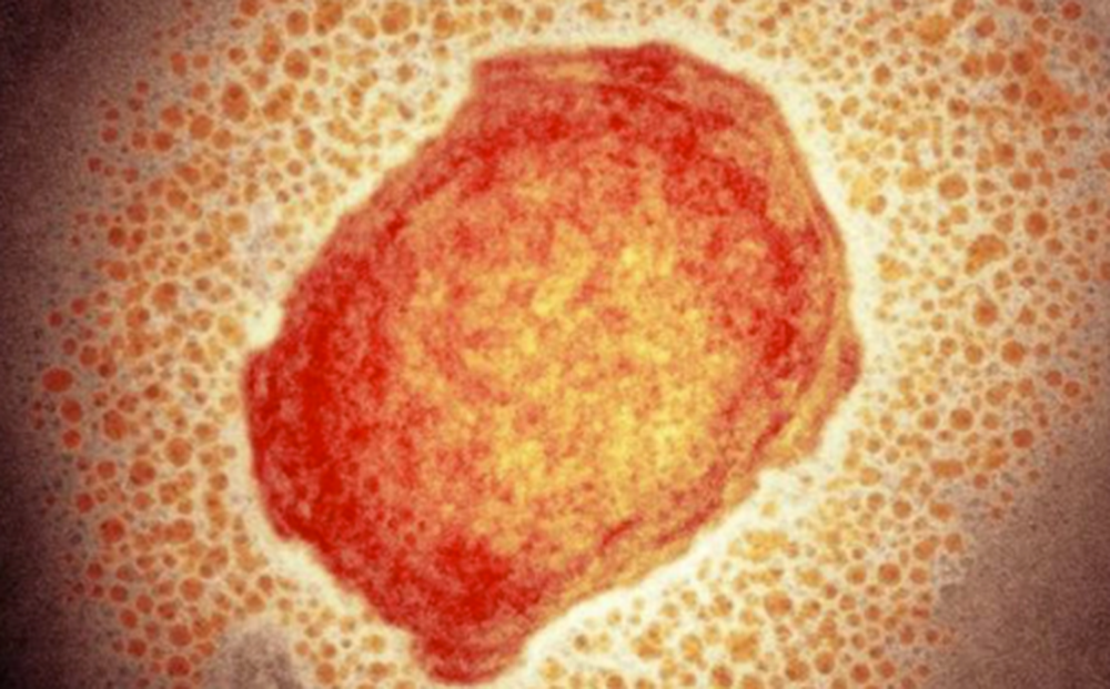 Bệnh đậu mùa khỉ: Virus gây bệnh nguy hiểm như thế nào?