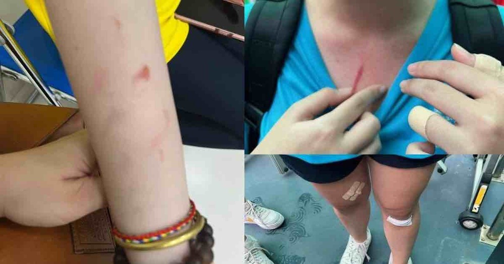 The case of the parents of the International School of Ho Chi Minh City accusing their children of being beaten by their classmates, the school received a 1-star rating from the school - Photo 1.