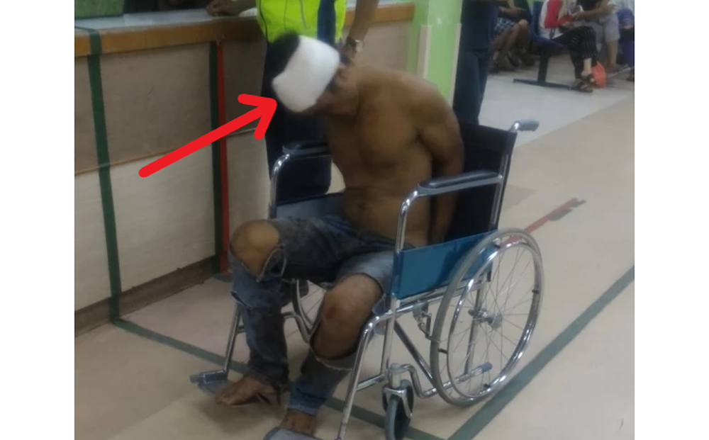 Nửa đêm mò vào nhà người khác, tên trộm không ngờ gặp phải "thứ dữ", thương tích đầy mình