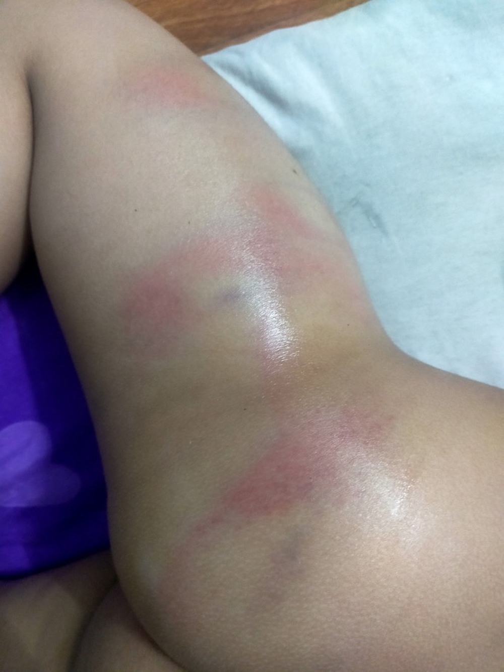 Công an vào cuộc việc bé gái 4 tuổi ở Bình Dương bị đánh bầm tím ở trường - Ảnh 1.