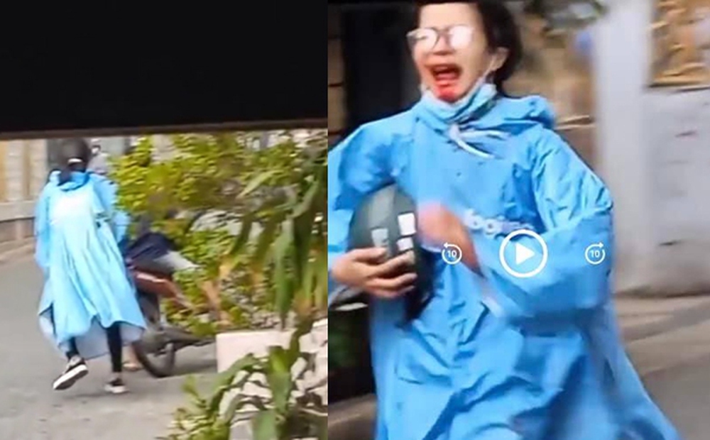 Thiếu nữ mồm đầy máu vì gãy răng đuổi theo người gây tai nạn khiến nhiều người xót xa