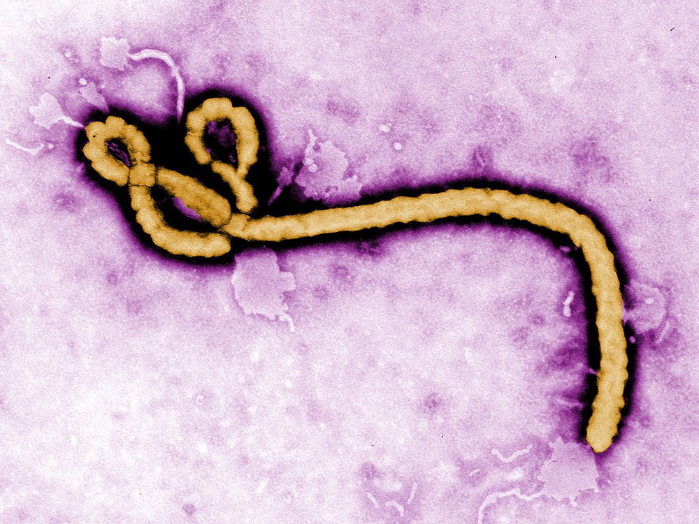 Loại virus mới được phát hiện ở Ghana nguy hiểm như thế nào? - Ảnh 1.