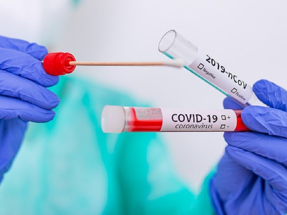 Thứ trưởng Bộ Y tế nêu nguyên nhân số ca mắc COVID-19 tăng trở lại - Ảnh 1.