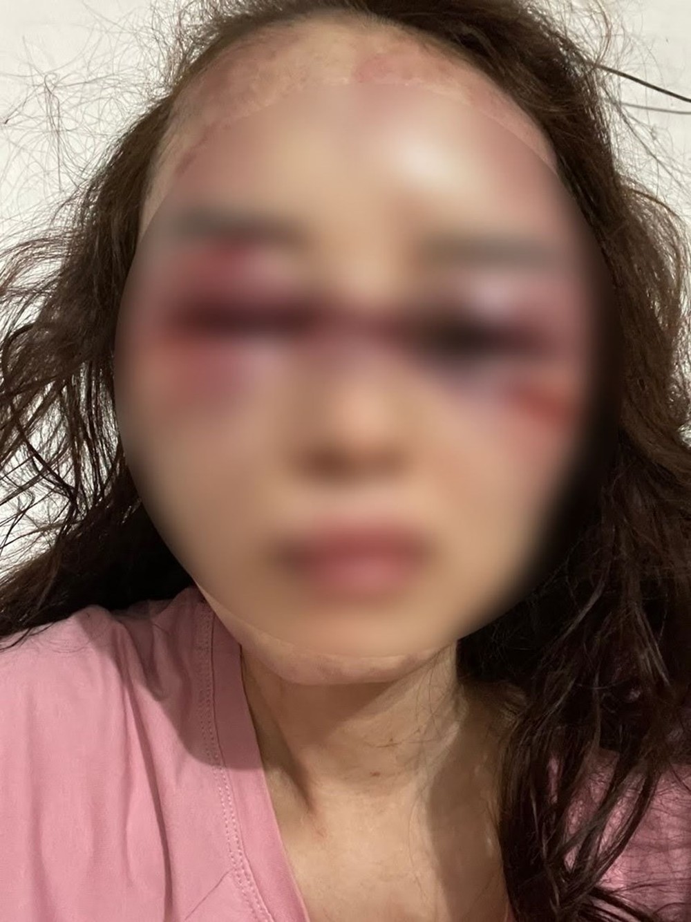 Người phụ nữ tố nhân tình đánh mình bầm dập sau khi hát karaoke - Ảnh 1.