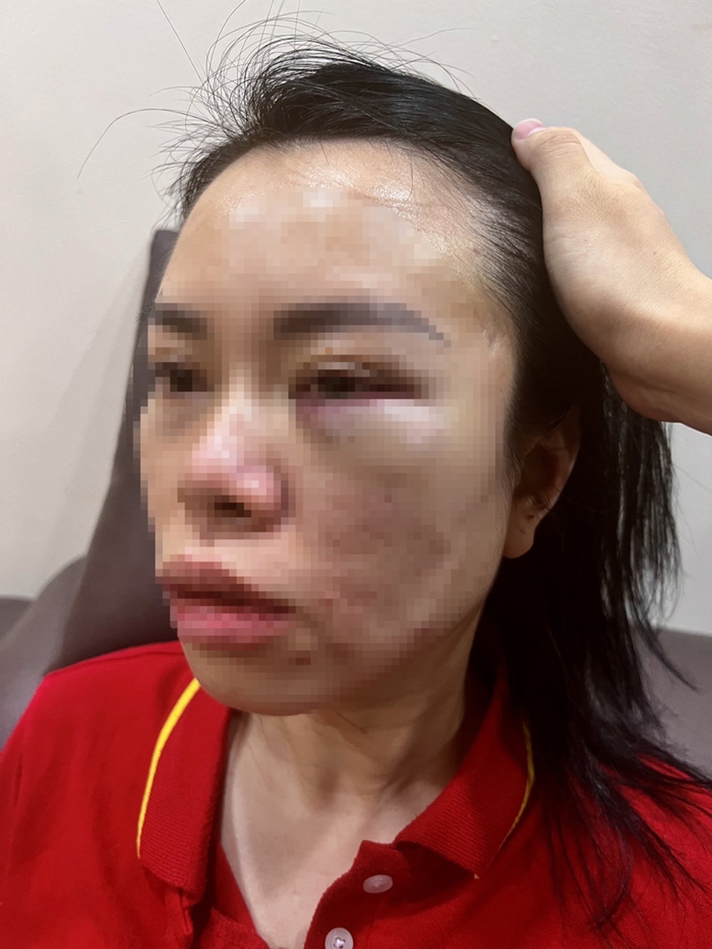 Người phụ nữ tố bị chồng cũ bắt cóc tra tấn dã man: Nhốt trong ô tô, đánh từ Hà Nội lên Hòa Bình - Ảnh 1.