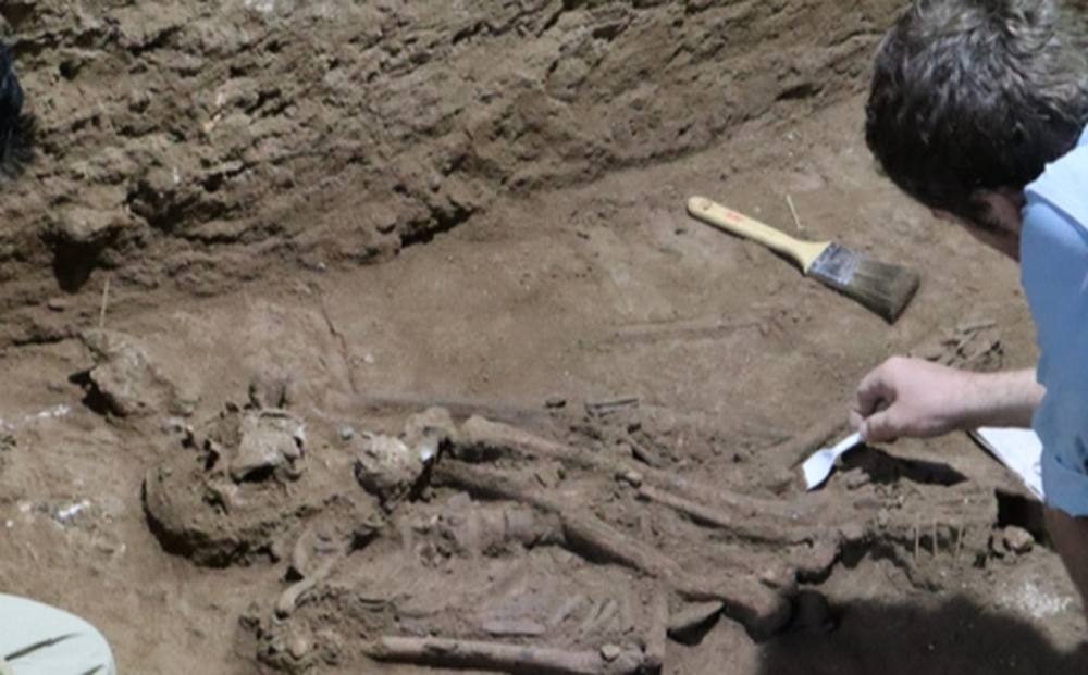 Hài cốt đảo lộn lịch sử ở Indonesia: Ca phẫu thuật sốc 31.000 năm trước