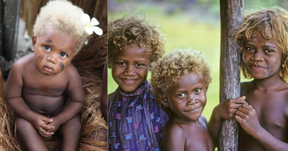Tại sao lại có những người da đen sở hữu mái tóc vàng tự nhiên? - Ảnh 4.