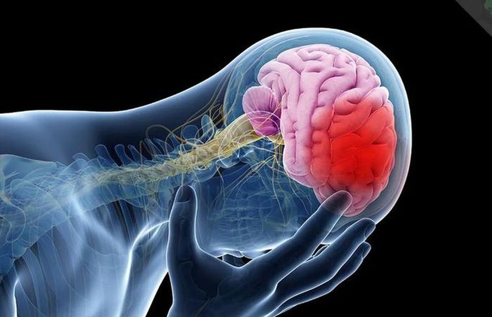 Đột quỵ sẽ tăng vọt, đặc biệt ở châu Á: Cảnh báo 4 lý do chính