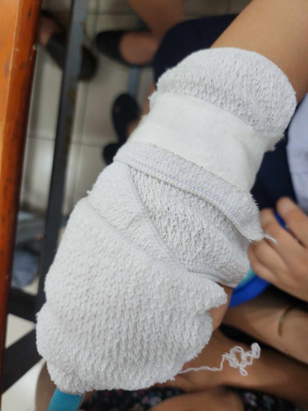 TP HCM: Phụ huynh tố giáo viên đánh gãy xương ngón tay học sinh - Ảnh 1.