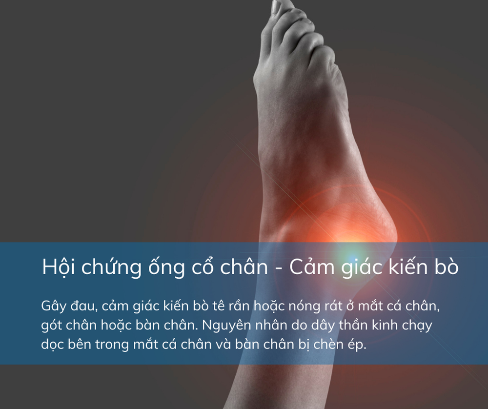 Cảm giác kiến bò ở lòng chân có thể cảnh báo bệnh lý mãn tính nguy hiểm - Ảnh 5.