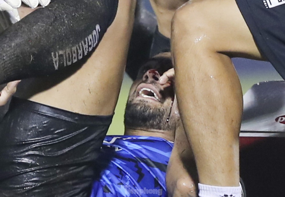 Cầu thủ CLB TPHCM sốc khi chứng kiến chấn thương của đồng đội - Ảnh 4.