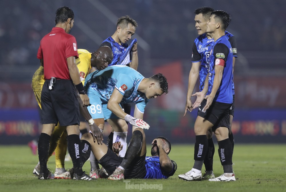 Cầu thủ CLB TPHCM sốc khi chứng kiến chấn thương của đồng đội - Ảnh 3.