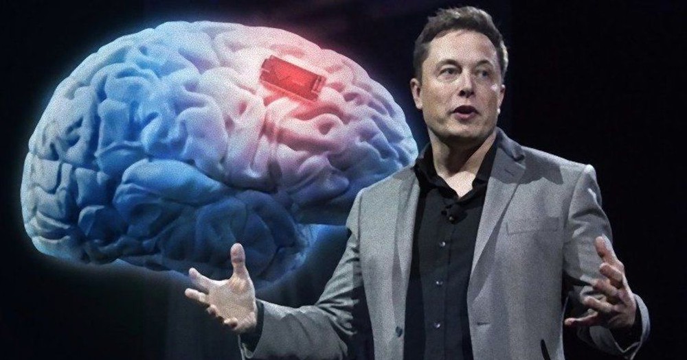 Elon Musk tuyên bố sẽ tự cấy chip não vào cơ thể mình - Ảnh 3.